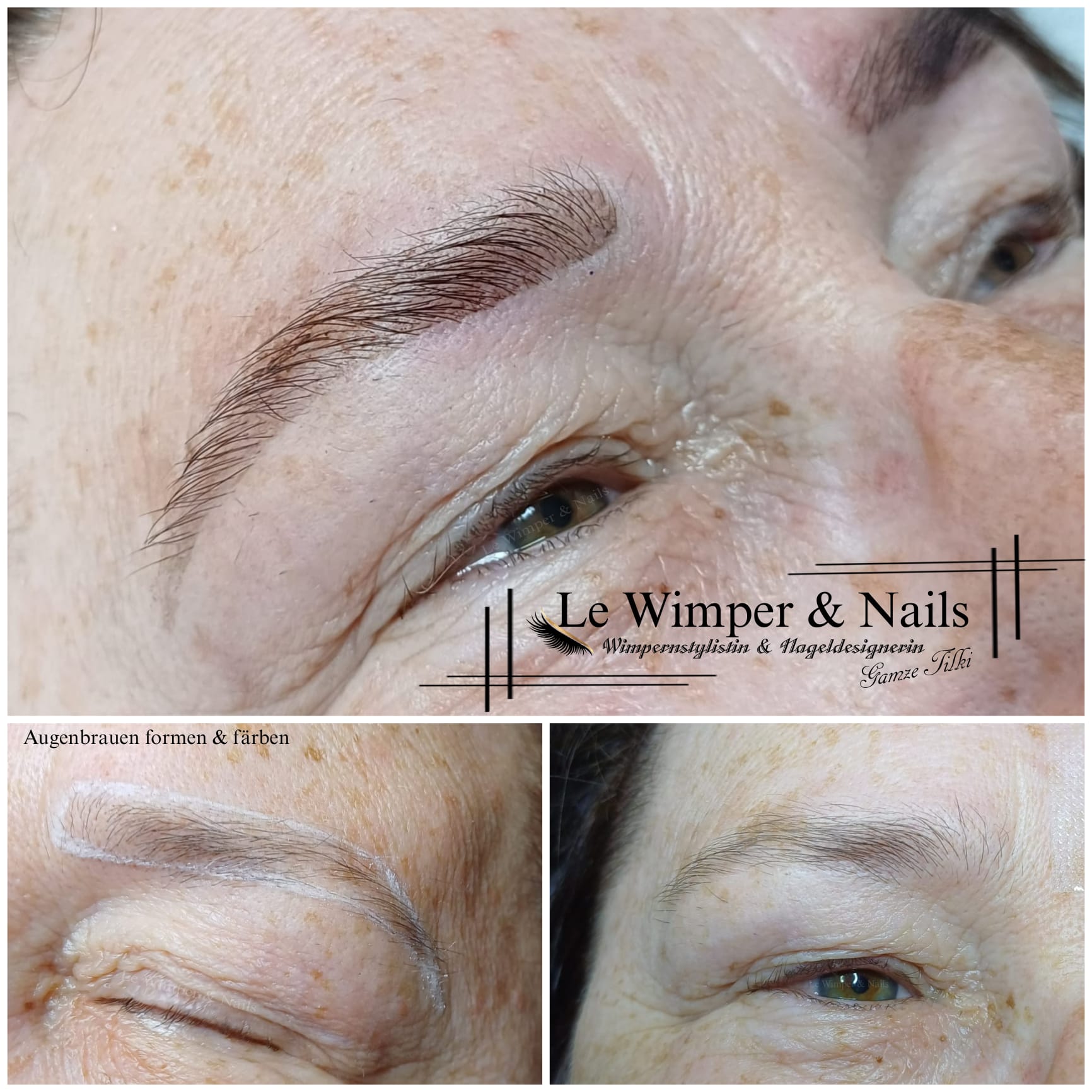 Browlifting Browlifting